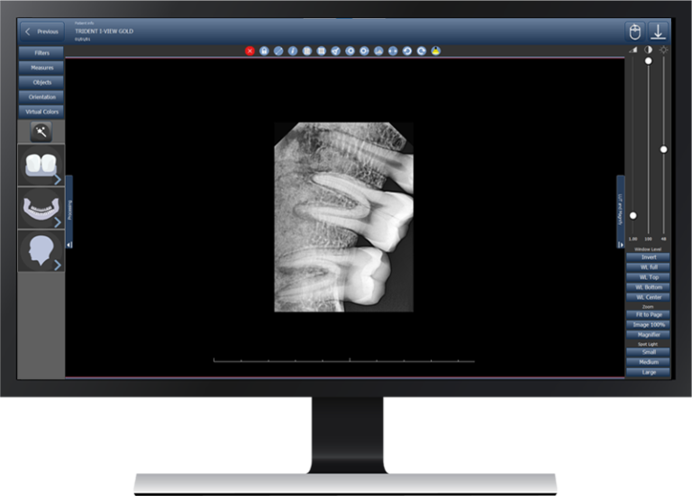 I-VIEW GOLD – CAPTEUR CMOS INTRA-ORAL