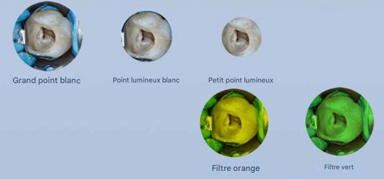 C-CLEAR-2 Microscope opératoire